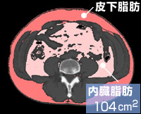内臓脂肪104平方cm