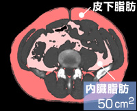 内臓脂肪50平方cm